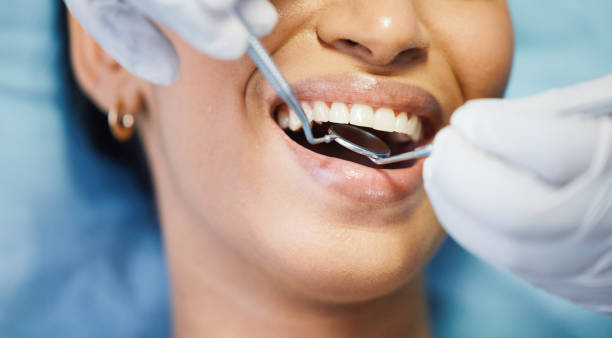 Best Emergency Dental Care for Abscessed Tooth in North Wildwood, NJ